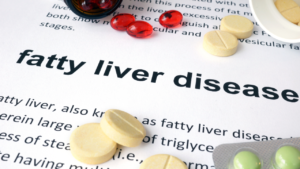 fatty liver disease